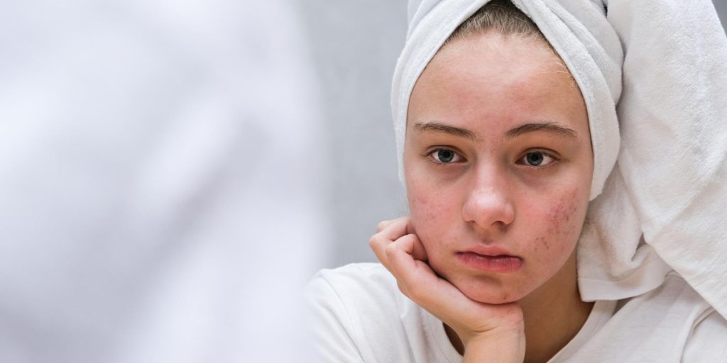facial treatment