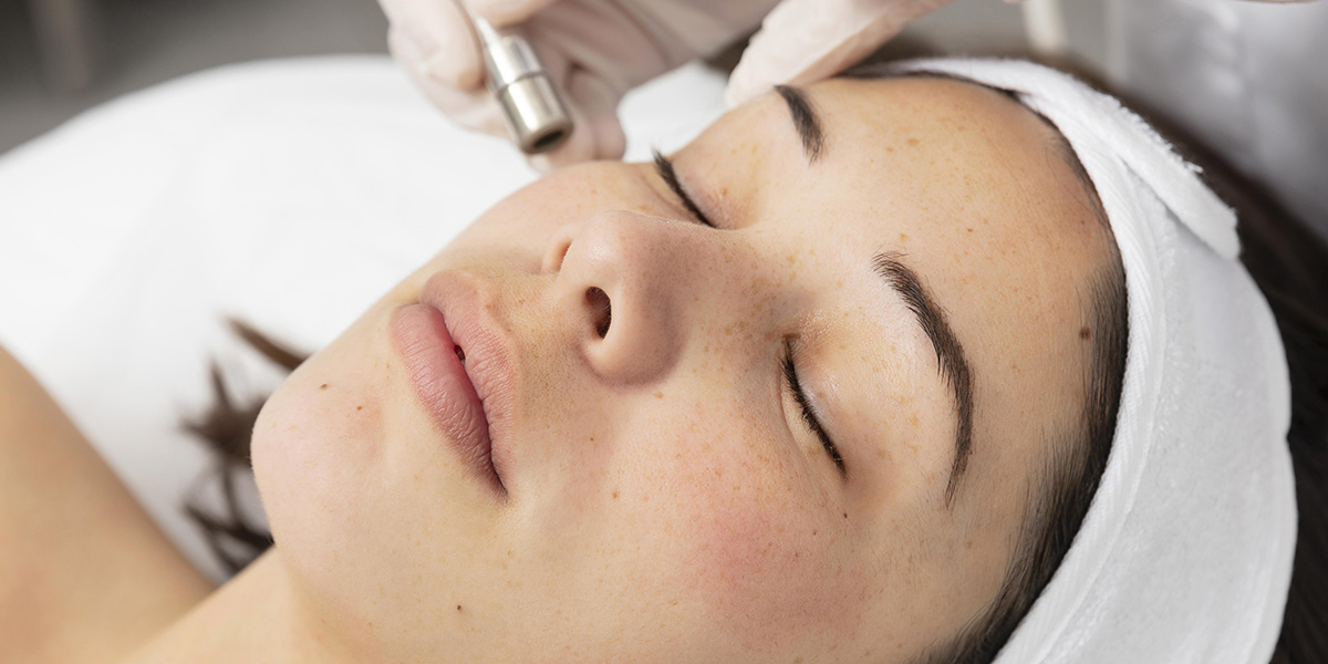 Puchong Pigmentation Removal